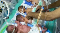 Cuatro bebés mueren de desnutrición en Gaza en las últimas 48 horas
