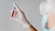 Detectar tumores con una muestra de sangre está muy cerca de ser posible