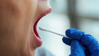 Un análisis de saliva podría revelar el riesgo de padecer enfermedades como cáncer o párkinson