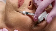 Inyecciones antiarrugas presuntamente falsas causan un brote de botulismo que deja al menos 38 afectados