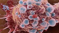 Identifican el gen que determina si las células del cáncer de mama formarán metástasis o permanecen dormidas