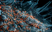 Nigeria Lassa Fever Death Toll Rises to 191