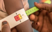 Nigerian Govt Raises Alarm Over 'Triple Burden' of Malnutrition