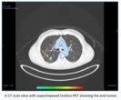 Oxford spinout RADiCAIT uses AI to make diagnostic imaging more affordable and accessible — catch it at TechCrunch Disrupt 2025