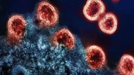 New breakthrough in quest for HIV vaccine
