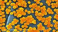 Superbugs could kill nearly 40 million people by 2050, study estimates