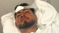 Adelaide man left for dead in alleged racially motivated assault