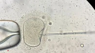 Monash IVF CEO resigns after second embryo bungle