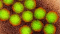Contagious disease not seen in Australia for over 50 years detected in wastewater