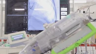 Robot used in heart attack procedure in world-first
