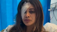NSW Police drop anti-riot charge against injured protester Hannah Thomas