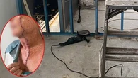 Man suffers gruesome injury using electric grinder at work