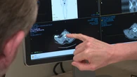 Revolutionary late-stage melanoma treatment sees survival rates surge