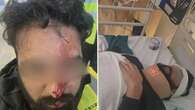 Melbourne Airport security guard seriously injured after alleged attack by Uber driver