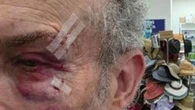 Melbourne pharmacy owner brutally assaulted in his own store