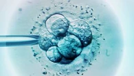 The affordable IVF game changer