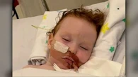Gold Coast toddler's condition improves after inhaling cake decorating dust