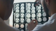 Australian-made drug shows promising results in concussion treatment