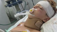 'He's gone': Boy's remarkable recovery from horror Bali quad bike accident