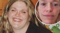 Jennei battled weight loss complications for years. Her doctors say she has scurvy