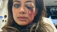 Accused police officer hit with new charge over assault of former Greens candidate