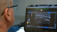 Aussie doctor pioneering game-changing treatment for common condition