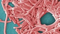 One dead after Legionnaires' disease outbreak in Sydney