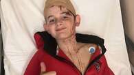 'It pinned him down': Boy, 12, needed surgery after brutal kangaroo attack