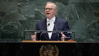 World 'cannot expect' US to lead, Albanese says in UN speech