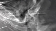 Closest ever photos of the sun reveal 'space weather threat' origins