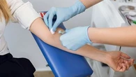 How a blood test could predict if and when you could get Alzheimer's
