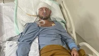 Family's battle to save Aussie found with mystery brain injury in Indonesia