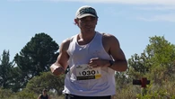 Runner raises over R30k for children’s facial operations