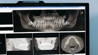 Accused 3 in Meyiwa trial didn’t have gold tooth: Dental report