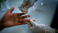 Motsoaledi confident Lenacapavir will help in fight against HIV/AIDS