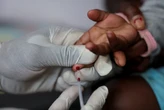 Researcher warns of surge in HIV infections amid US funding cuts