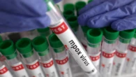 Senegal reports mpox case, patient in isolation