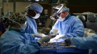 Everything medically possible was done to save conjoined twin: Motsoaledi