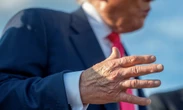 Trump diagnosed with vein condition causing leg swelling