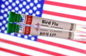 Bird flu virus shows mutations in first severe human case in USA