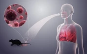 WHO praises SA’s role in Hantavirus response