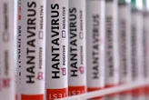 Government monitoring Hantavirus cases amid public concern: Creecy
