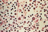 SA working with WHO to trace hantavirus cases locally