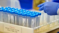 KZN’s COVID-19 infection rate going up steeply: Premier