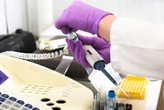 University of Pretoria develops 3D skin replacement product