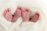Motsoaledi visits Mankweng Hospital after death of one of the conjoined twins