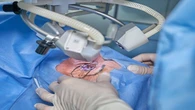 GP launches cataract surgery marathon to restore patients’ sight
