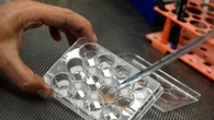 Passo avanti nella diagnosi della Sla, studio fra Torino e Usa
