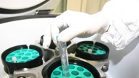 Ricerca oncologica, Ateneo Firenze guida progetto europeo