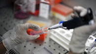 Hiv, identificati 'codici' immunitari per sospensione cure